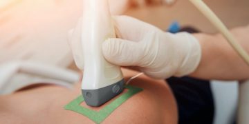 Vexev Develops The World’s First Ever Tomographic Ultrasound Robot