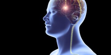 China Approves First Brain Implant for Commercial Use